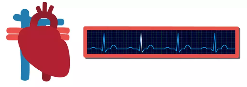 Grafik Herz und EKG-Kurve. Beim Klick öffnet sich eine Animation verschiedener Herzkurven