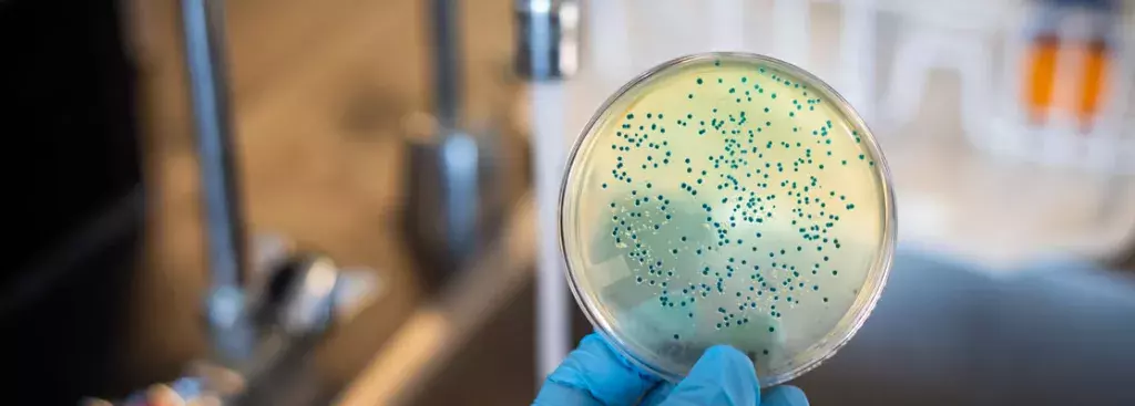 Parasiten, Bakterien und Viren zuverlässig mit PESU-Membranen entfernen -  Wassermeister