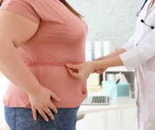 Arzt misst Bauchumfanges bei einer übergewichtigen Frau